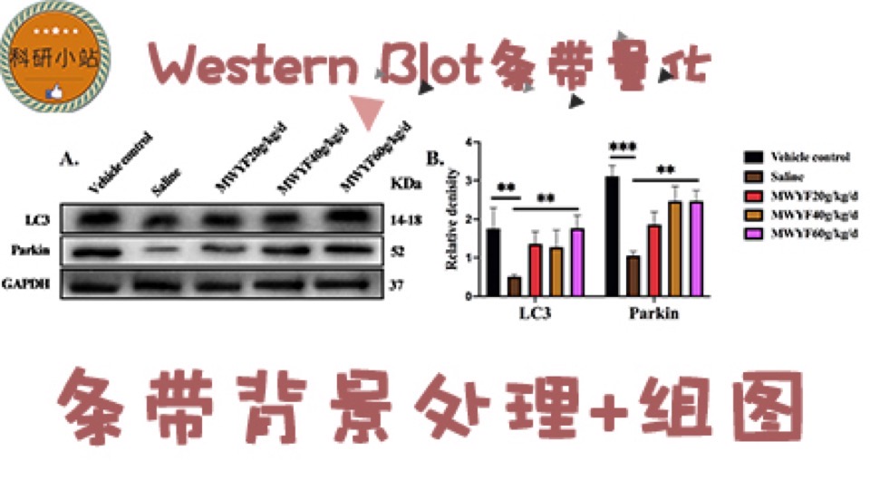 western blot蛋白条带量化作图-限时优惠